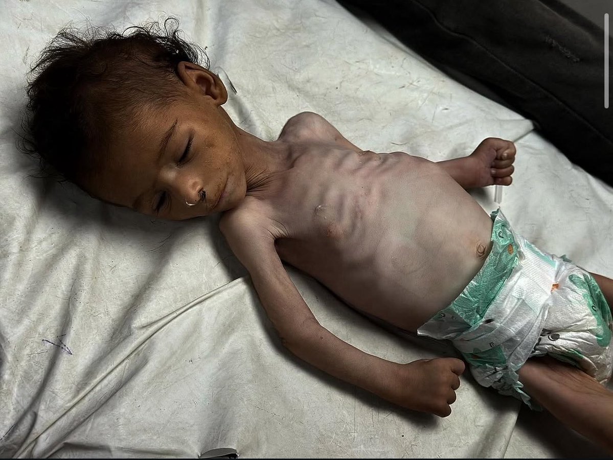Israel continues to starve the people of Gaza.