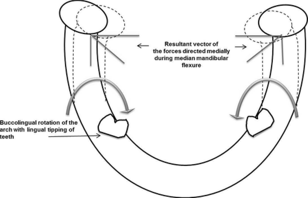 Mandibular Flexure
dentagama.com/news/mandibula…