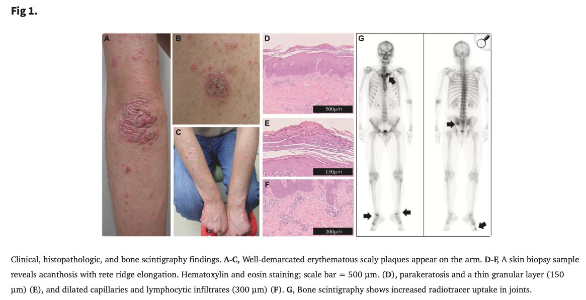 SoS@皮膚科専門医試験対策編 tweet media