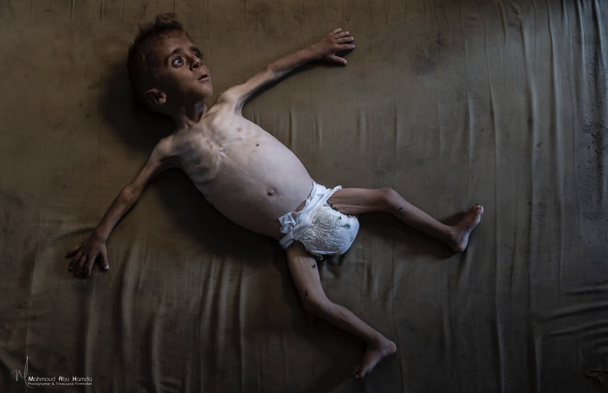 InsardiJ's tweet image. Nous en sommes à discutailler( même dans notre camp) de la pertinence de la reconnaissance de la Palestine , alors que nous devrions parler d'une opération militaire et humanitaire d'urgence pour arrêter ça.