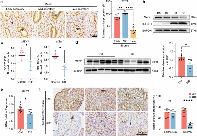 CommsBio's tweet image. Endometrial stromal Menin supports endometrial receptivity by maintaining homeostasis of WNT signaling pathway through H3K4me3 during WOI: Communications Biology, Published online: 04 July 2025; doi:10.1038/s42003-025-08434-9Stromal Menin upregulates the… nature.com/articles/s4200…