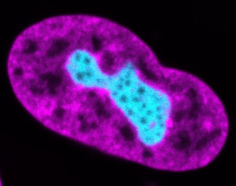 CuylenLab's tweet image. Ever wondered why nucleoli often have such complex shapes—despite behaving like liquids?
If liquids tend to form spheres, why don’t nucleoli?
What shapes them? We explore this in our latest preprint @embl.
Great work led by Daja Schichler & @YH_YukiBio!
biorxiv.org/content/10.110…