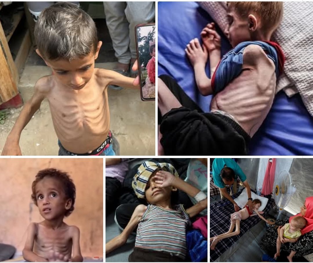 P_M_1960's tweet image. C'è chi si è stracciato le vesti leggendo la parola genocidio usata da Francesco in un libro, ma a Gaza siamo oltre la follia, è all'opera il male più sfrenato e senza logica. L'uccisione di bambini in fila per un pugno di riso grida giustizia.
(Cardinale Augusto Paolo Lojudice)