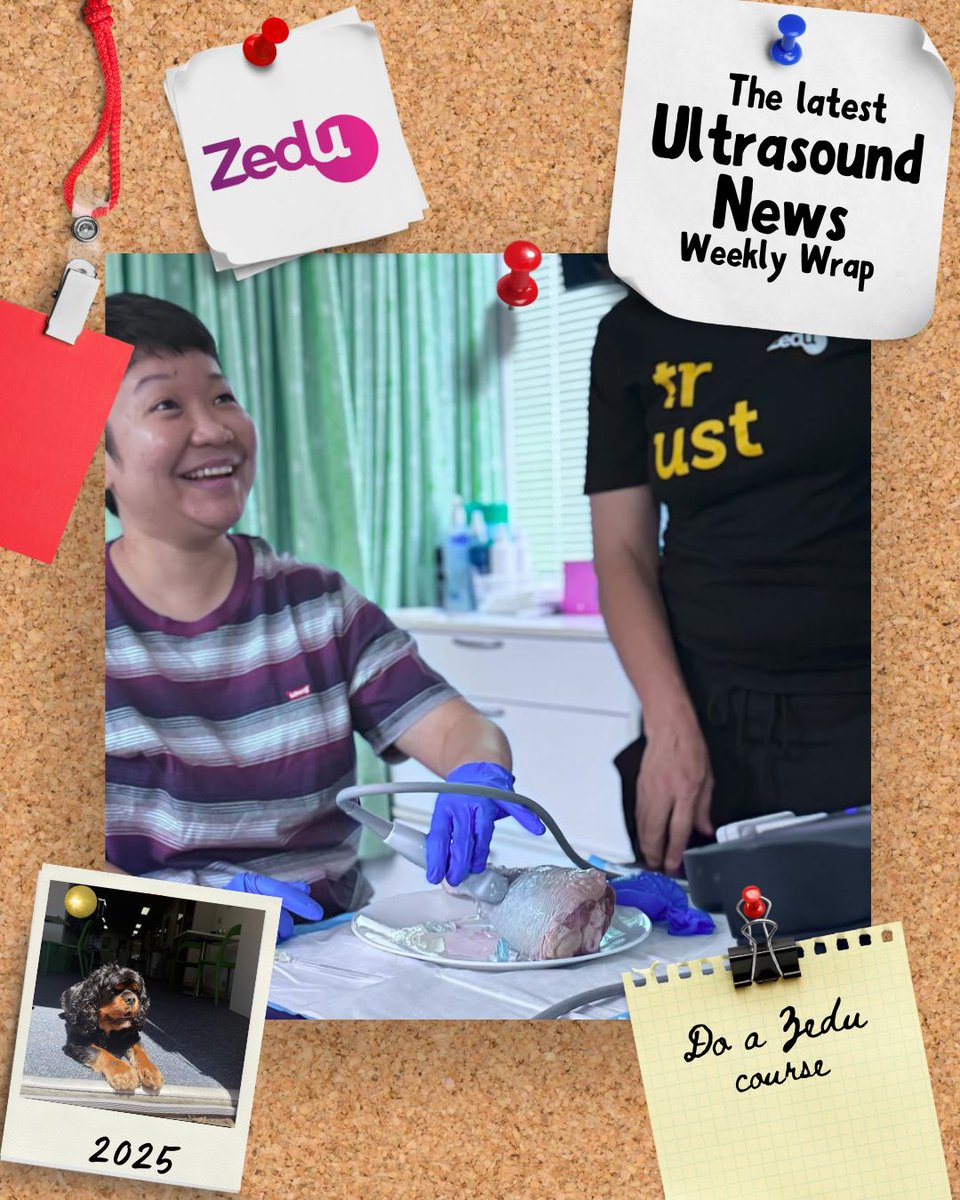 Zedu Ultrasound Training @zedunow@med-mastodon.com (@zedunow) on Twitter photo 😎The weekend is here, and so is the #weeklywrap
Sit back, relax & read all the latest & greatest in #ultrasound #pocus news & views
🔥Get it free while it's hot
ultrasoundtraining.com.au/news/zedu-week…
#ultrasoundtraining #foamed #meded #zedu 😎The weekend is here, and so is the #weeklywrap
Sit back, relax & read all the latest & greatest in #ultrasound #pocus news & views
🔥Get it free while it's hot
ultrasoundtraining.com.au/news/zedu-week…
#ultrasoundtraining #foamed #meded #zedu