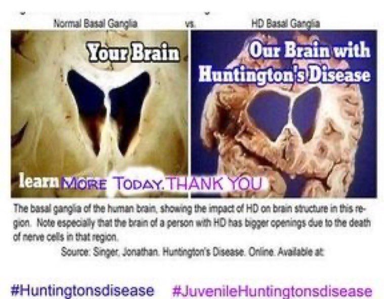 HDAwareness2024 (@hdawareness2024) on Twitter photo 