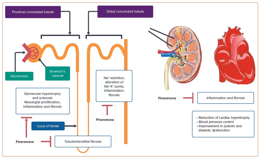 Finerenone: Will It Be a Game-changer?

Its combination with therapies, such as sodium–glucose cotransporter 2 inhibitors, shows promise and ongoing trials, such as REDEFINE-HF, FINALITY-HF and CONFIRMATION-HF, are investigating its efficacy in other HF phenotypes. 

These