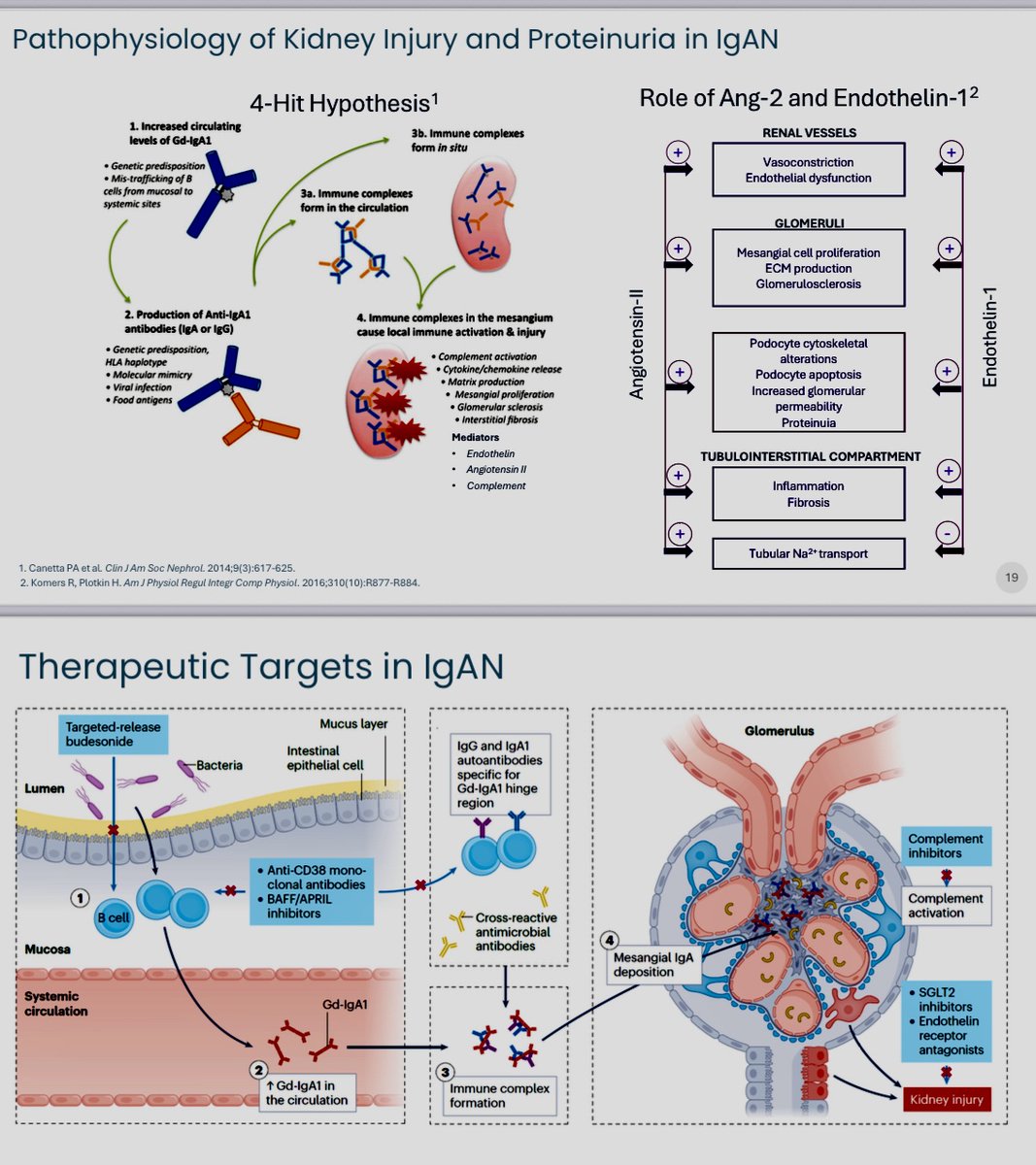 IgA nephropathy
