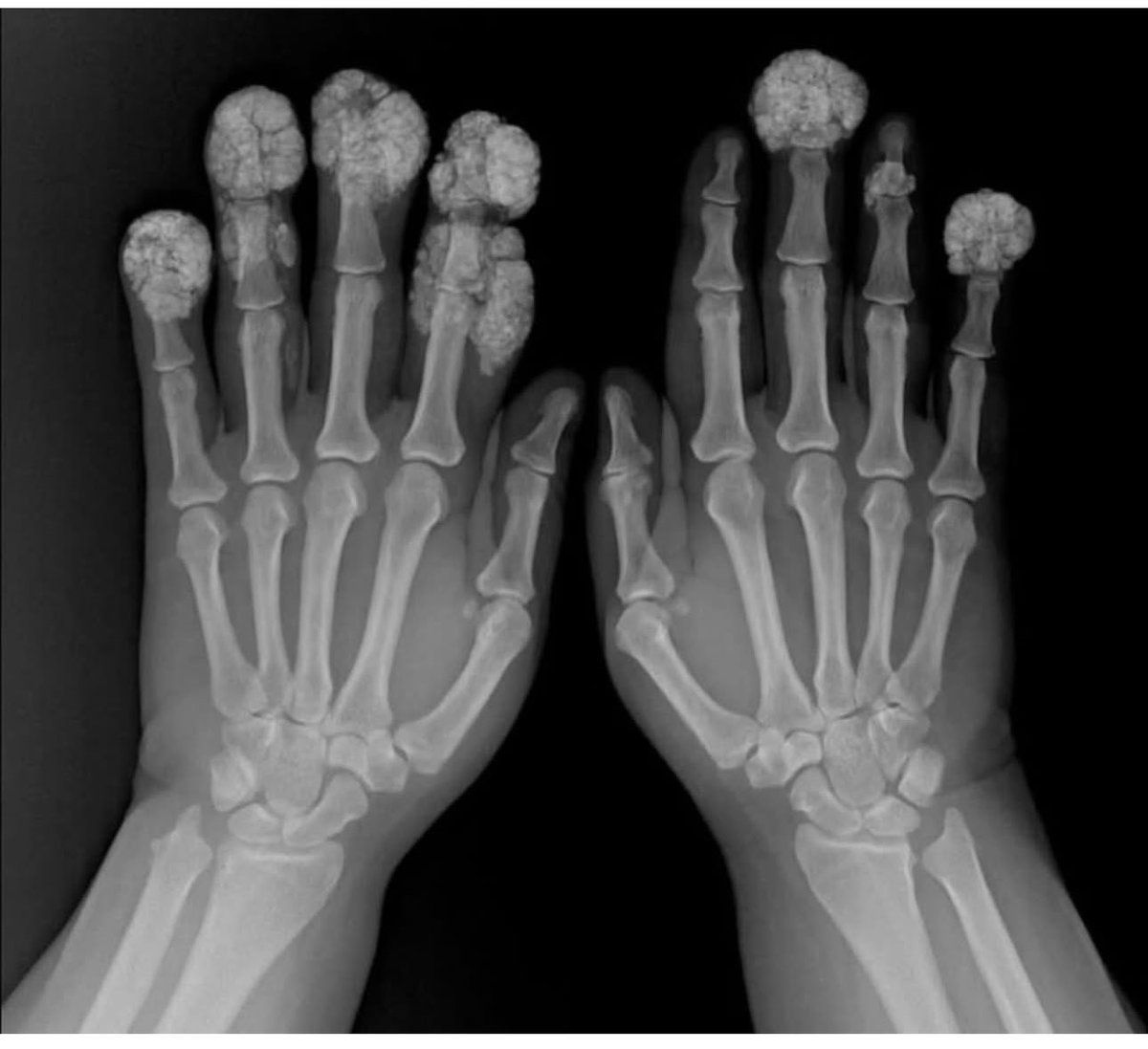 MoAImam's tweet image. What is wrong? Case by Gabriel Orlando González Herrera