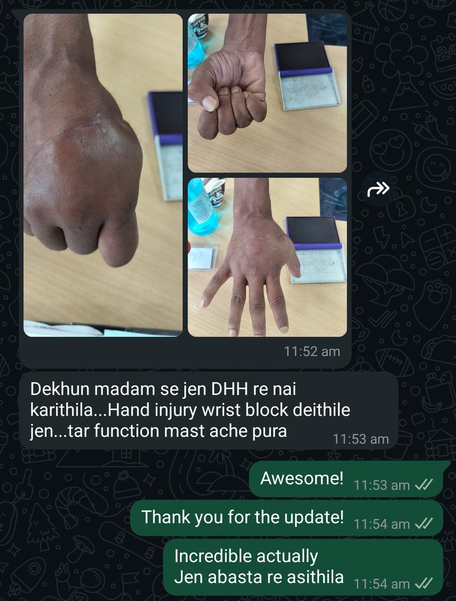 nehapadhi's tweet image. Working in a peripheral institute with limited resources trying to do our best.
Grateful to have an ortho dept which acknowledges my part in a case done months back:Repair of crush injury done under #pns guided wrist #block,now almost full function restored
#Anaesthesia
#India