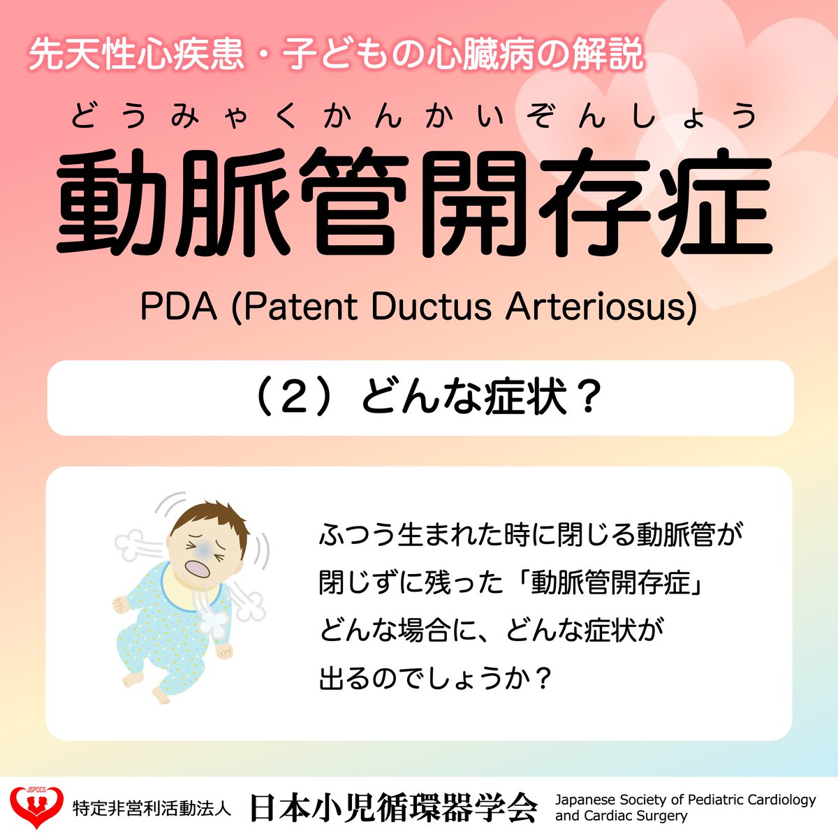 JSPCCS's tweet image. 【公式Instagramより】
 
❤️子どもの心臓病の解説 ❤️

＼動脈管開存症の症状！／

動脈管開存症はどんな症状で、
どうしてそのような症状が出るのか、
について説明します。

♡･････♡･････♡･････♡･････♡･････♡
詳しい内容は…
日本小児循環器学会一般向けホームページ…