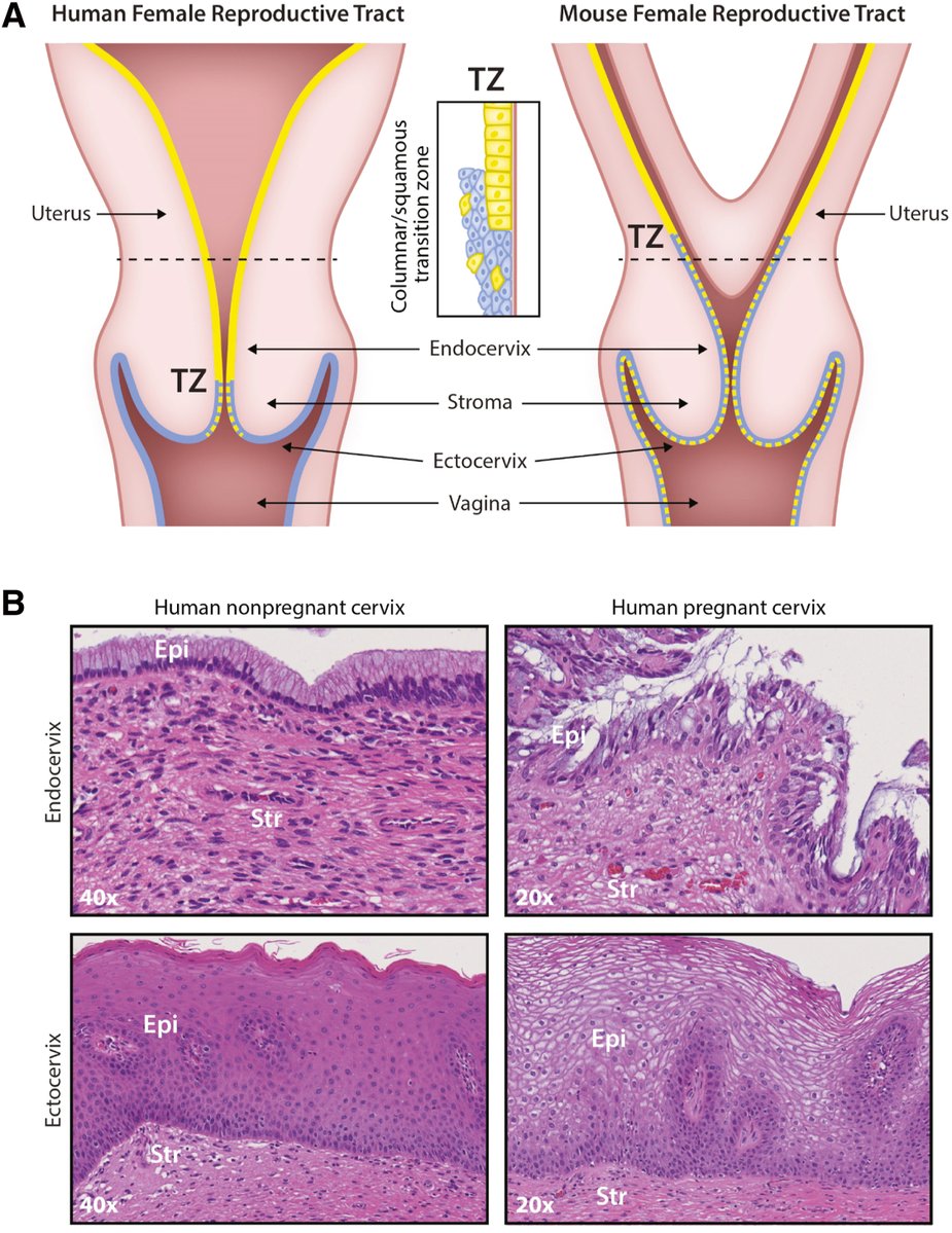 AJOG_thegray's tweet image. AJOG Expert Review: Cervical function in pregnancy and disease: new insights from single-cell analysis - Comparison of the human and mouse reproductive tract ow.ly/j7Oa50Wvaku