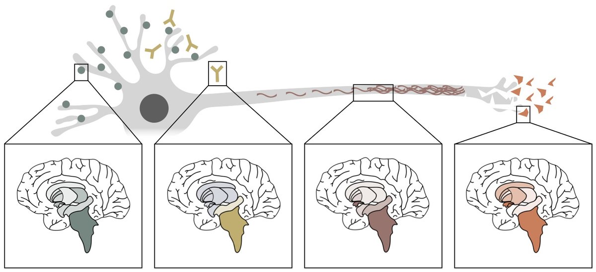 Yogeshwar et al. present clinical and MRI data from 127 patients with anti-IgLON5 disease. They show brain atrophy patterns that closely mirror sites of autoantibody binding and tau accumulation, with the location of atrophy linked to specific symptoms. tinyurl.com/3u4ufv2z