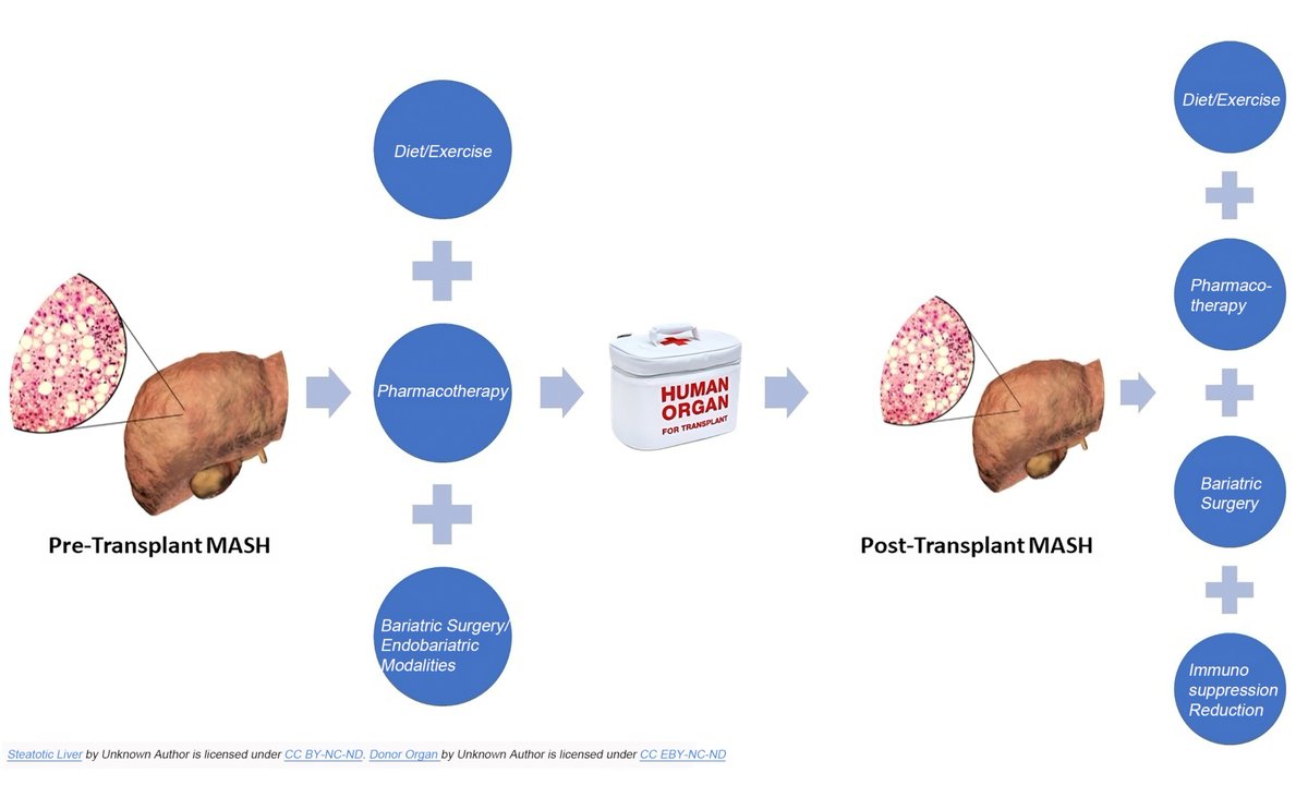New Review Alert!
 Metabolic dysfunction-associated steatotic liver disease (MASLD) across the liver transplant cycle—challenges, organ allocation, post-LT outcomes &amp; more.
By Brian J. Wentworth
🔗 doi.org/10.20517/mtod.…
#MASLD #LiverTransplant #Hepatology
