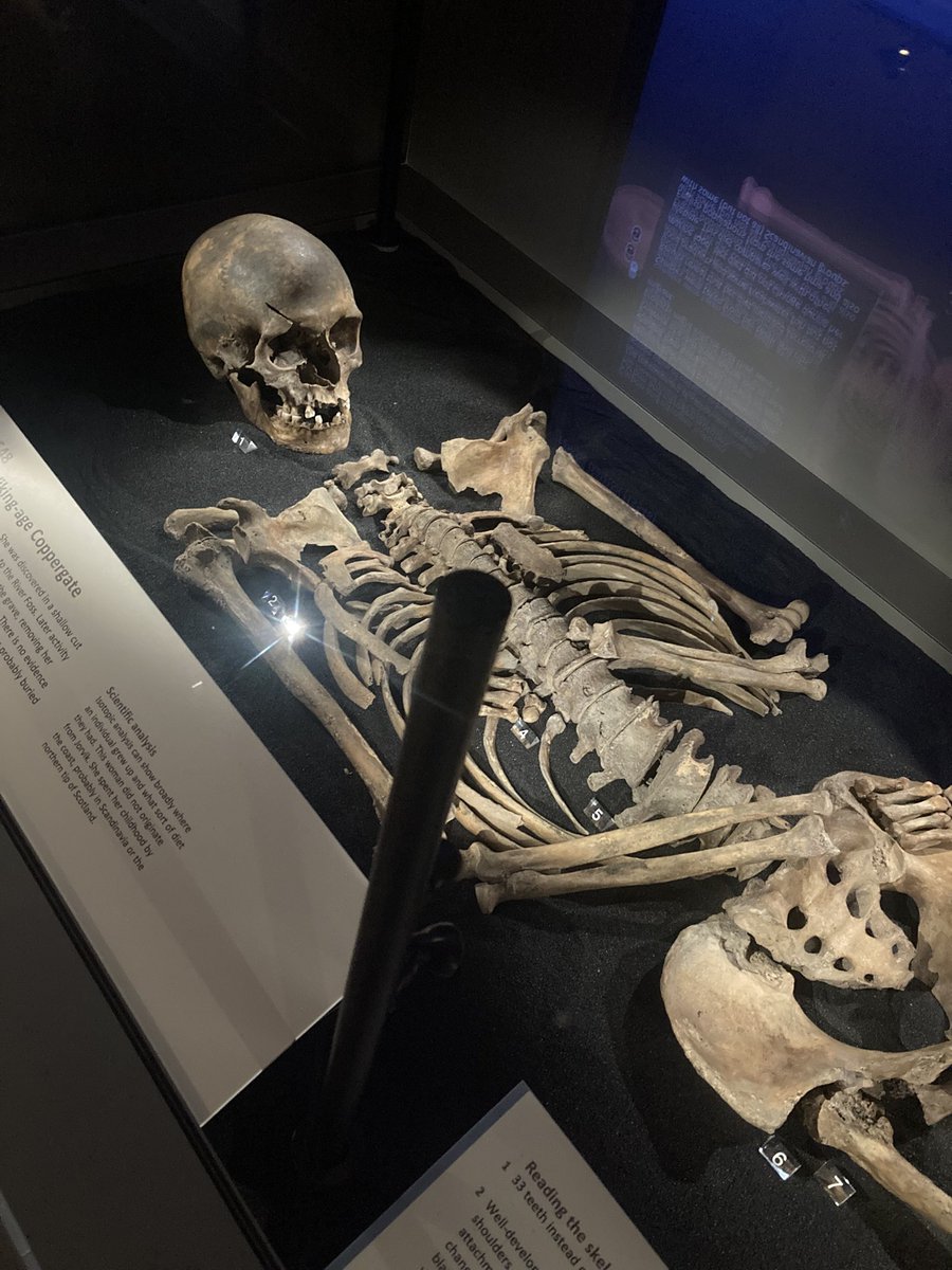 DrAimeeQuicks's tweet image. Have had a lovely time with our invading Norwegians (my little brother and family) emptying Whitby of crabs, meeting Vikings in York and just generally mucking about.