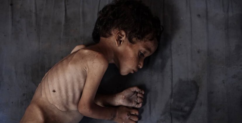 اين دول الاتحاد الأوروبي 
اين دول العالم الإسلامي 
اين القانون الدولي الإنساني 
اين اتفاقيات حقوق الانسان 
اين المحكمة الجنائية الدولية
اين ضمير العالم ؟