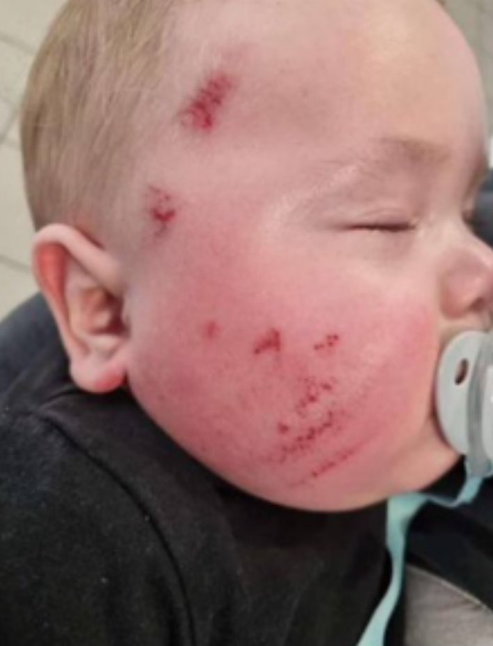 mtwardowski__'s tweet image. ‼️🚨🇩🇪 Tragedia w Niemczech.

Subsaharyjscy imigranci wyrzucili matkę i jej 8-miesięczne dziecko z wagonu pociągu na stacji kolejowej w Kusel w Niemczech.

Dziecko wypadło z wózka, upadło twarzą w dół na ziemię i jest w ciężkim stanie... 😥

Niemiecka policja potwierdziła…