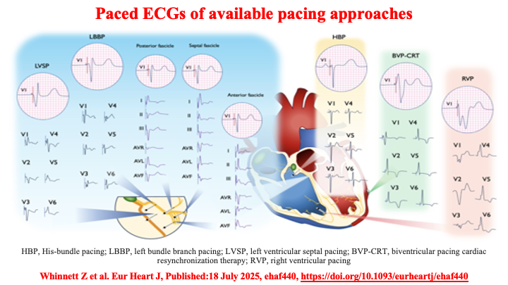 Raviele Antonio tweet media