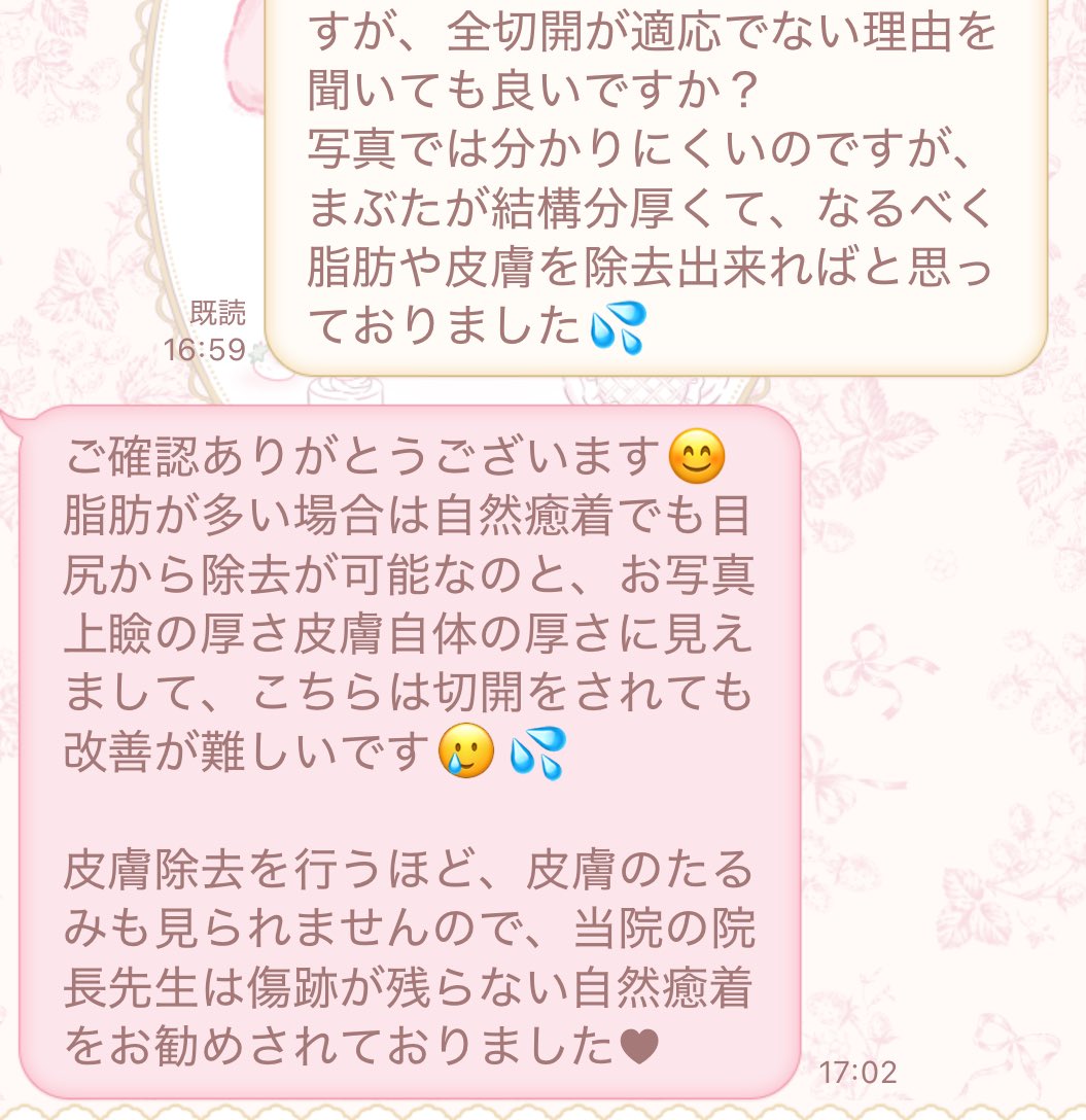 minchannell's tweet image. 全切開じゃなくて自然癒着適応って言われたんだけど(;-;)
私は自然癒着を信用してない、埋没を複雑にするだけで半永久とか、そんなわけなくない?って思っちゃう、、