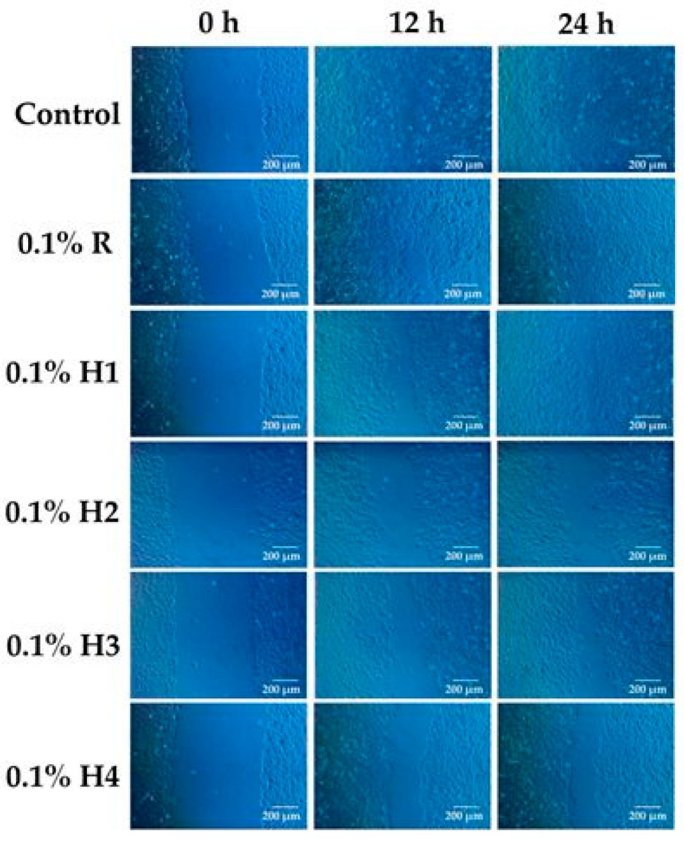 Applsci's tweet image. 🔥 Read our Highly Cited Paper
📚 Coniferous #HoneydewHoney: #AntibacterialActivity and Anti-Migration Properties against #BreastCancerCellLine (MCF-7)
🔗 mdpi.com/2076-3417/14/2…
👨🔬 Małgorzata Dżugan et al.
🏫 @UR_Rzeszow / @PolitechnikaRz
#antioxidant #antibacterial…
