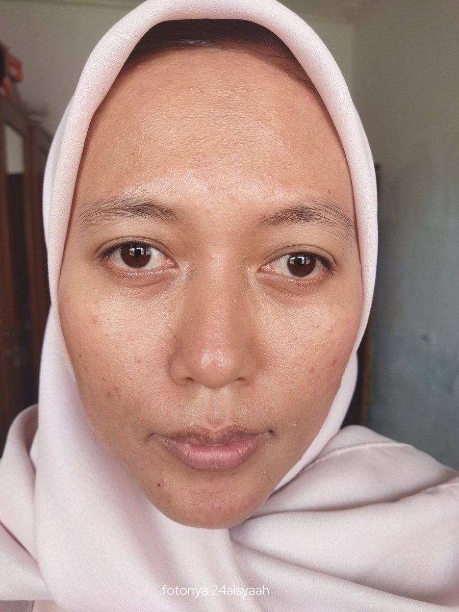 24aisyaah's tweet image. Hampir 3 minggu jalanin pola hidup yang gak sehat, males olahraga, males skincare-an, makan tepung & gula. Hasilnya begini deh. Kulit kering, merah-merah, bruntusan.
Dan karena 'urusanku' udah hampir selesai, yuk kita balik lagi ke yang paling basic, yaitu perbaikin skin barrier!