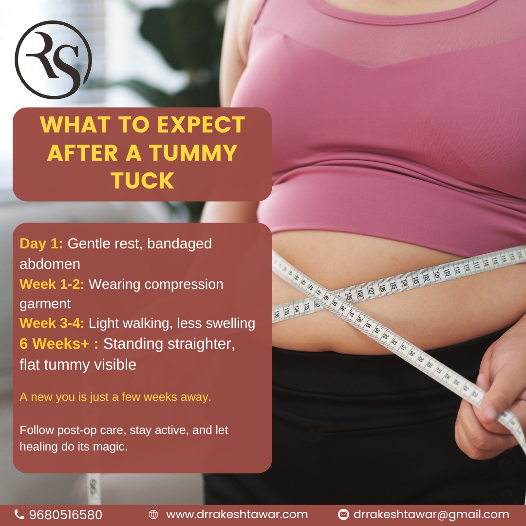 Tummy Rested Dreaming of a flatter, firmer tummy? Here’s what recovery looks like ...