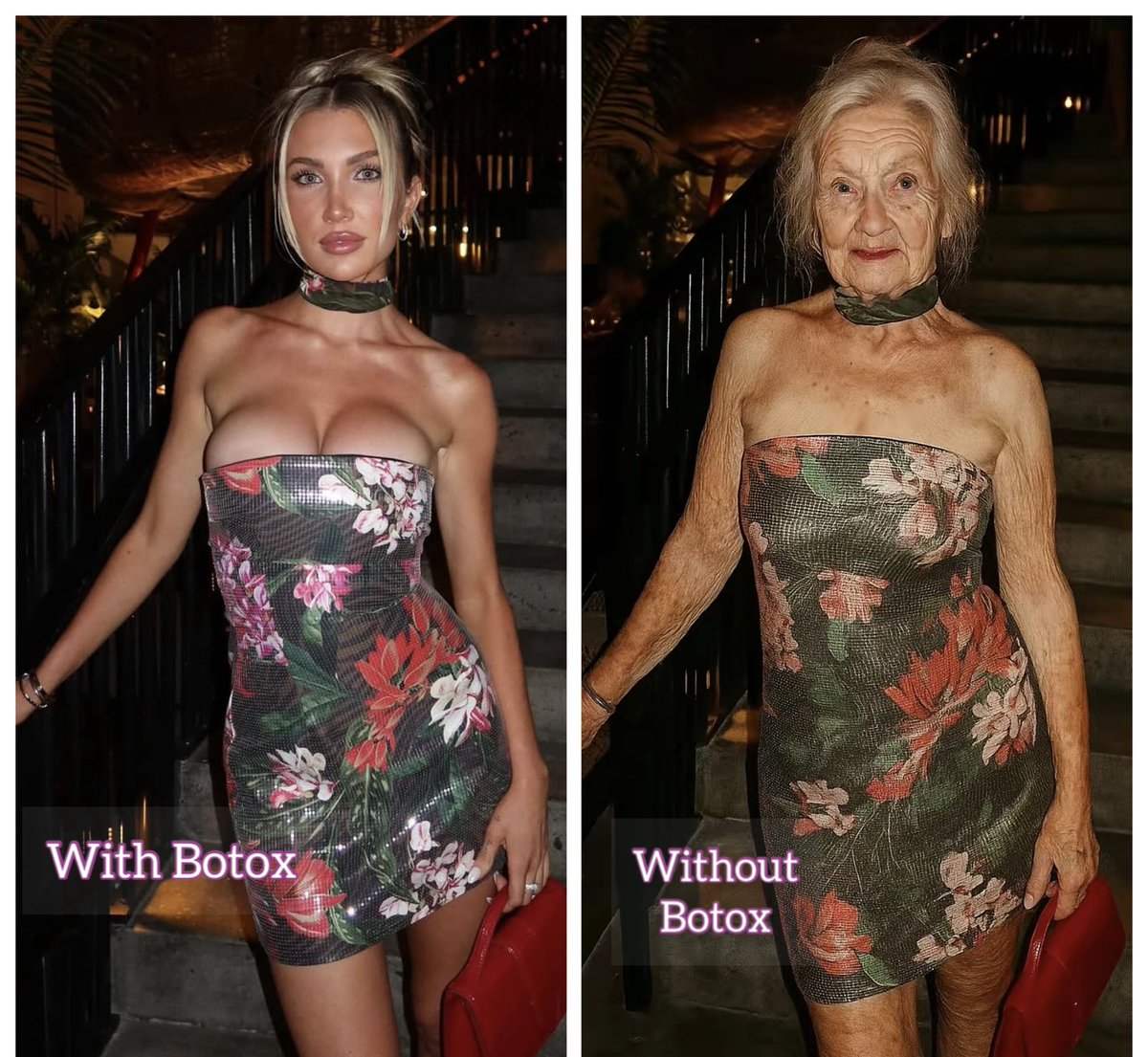 justice4LiamWeb's tweet photo. So the Botox and when well you know 🤣🤣🤣

#ExposeKateCassidy #Katefake #KateTheSnake https://t.co/QwhllvJx5Y