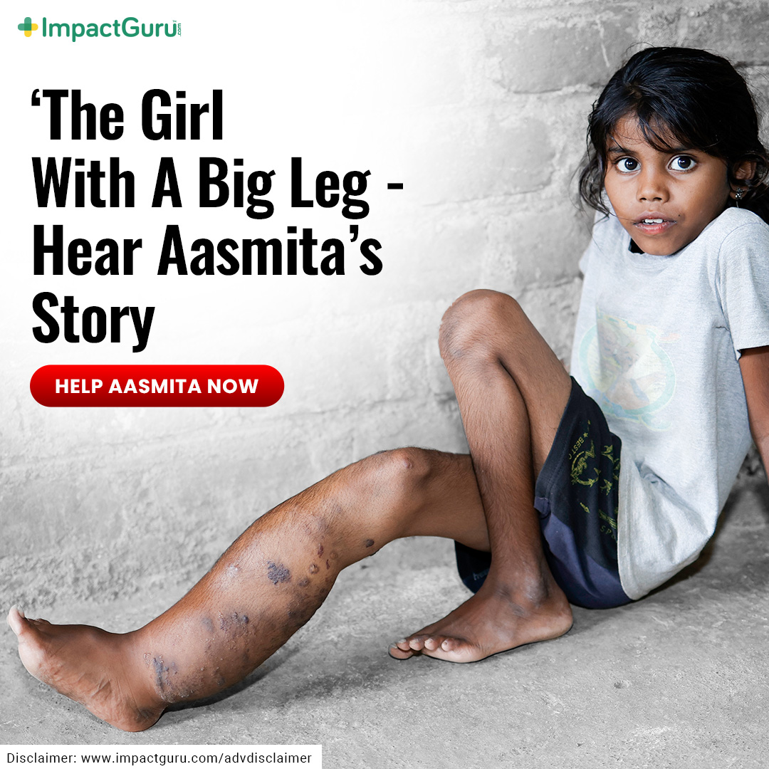 No one knew a small lump would grow into a daily source of pain. Now 10, Aasmita's leg is swollen from a rare condition - Lymphedema AV Malformation. She dreams of running, playing, just being a child again.

With your #support, that dream can come true: impactguru.com/s/6MNNWL