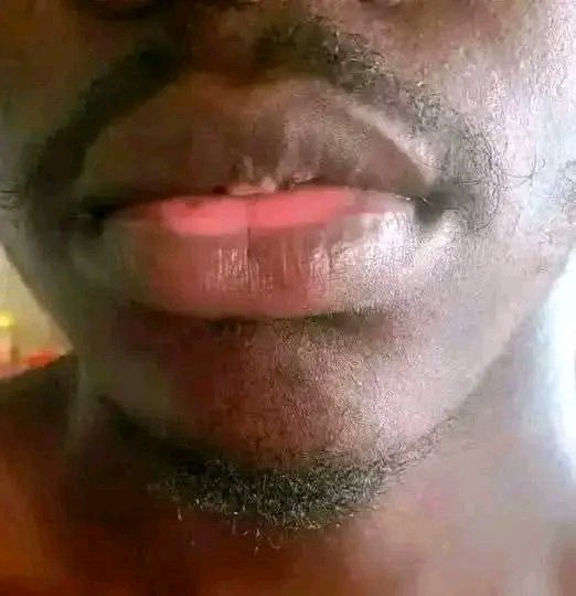 majoyana31's tweet image. In your language what do you call this lip condition?In Xhosa we call it ISPAWUNYERI‼️😩
#Relebogile #Nonku