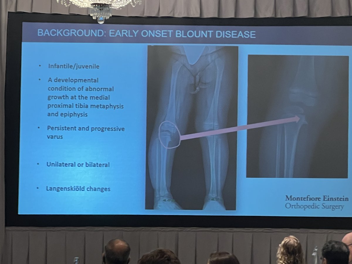 MontefioreOrtho's tweet image. Montefiore Orthopedics showed up strong at LLRS 2025.
Drs. Melinda Sharkey and Mani Kahn presented cutting-edge limb deformity research alongside their teams, with multiple podiums and posters featured on 7/18 in Philly.
Shoutout to:
📚 Morgan Roche + Mihir Sharma, Medical…