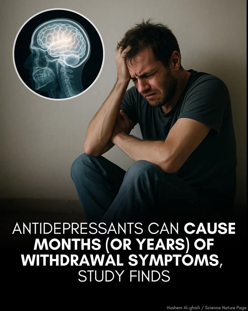 JaysonDC123's tweet image. ⚠️ Quitting antidepressants is like quitting a highly addictive drug, new research shows.

Users may face months of withdrawal symptoms — or even years.

Experts are calling it a public health crisis.

People who quit antidepressants may experience severe and long-lasting…