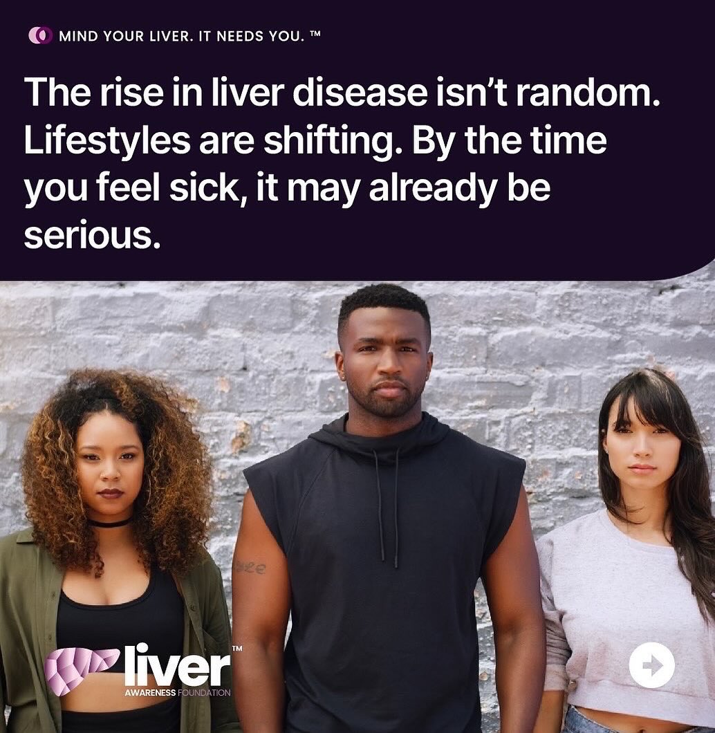 LiverAwareness's tweet image. Alcohol-associated liver disease is one of the top threats to young adults.
But it’s not the only one.
MASLD. Viral hepatitis. Inflammation. Drug-induced damage.
It’s time we stop pretending liver disease only looks one way.
#MindYourLiver #ALD #LiverHealth #YoungAdults