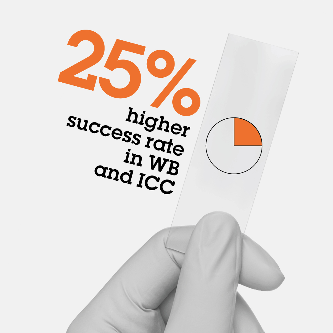 abcam's tweet image. Drive 25% higher success in WB and ICC when using Abcam’s recombinant rabbit monoclonal antibodies made using our RabMab® technology. Learn more: bit.ly/430fBFf