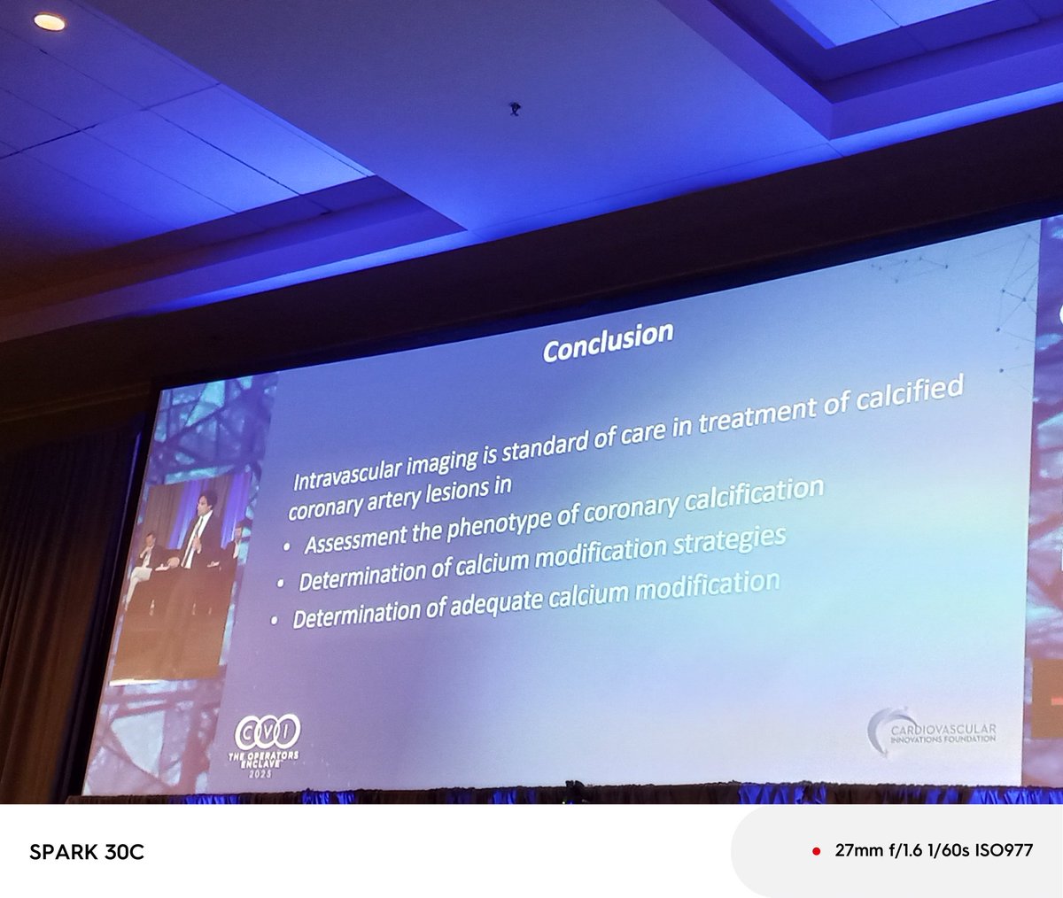 Zainab Dakhil (@zainabdakhil2) on Twitter photo More on #IC imaging , now in #calcium cases from <a href="/AllanaSalman/">Salman Allana, MD FACC FSCAI</a> <a href="/cvinnovations/">CV Innovations</a> #CVI2025 <a href="/kerrigjl/">Jimmy Kerrigan</a> <a href="/esbrilakis/">Emmanouil Brilakis</a> <a href="/arnoldseto/">Dr. Seto</a> <a href="/FaroucJaffer/">Farouc Jaffer MD PhD</a> <a href="/shishem/">Mehdi Shishehbor, DO</a> <a href="/psorajja/">Paul</a> <a href="/timir_paul/">Timir Paul, MD, PhD, FACC, FSCAI, FAHA</a> <a href="/Pooh_Velagapudi/">Poonam Velagapudi</a> <a href="/rajivxgulati/">Rajiv Gulati</a> <a href="/RhianEDavies1/">Rhian E. Davies DO MS</a> <a href="/calmanoj/">Manoj Kesarwani, MD (he/him/his)</a> <a href="/GutoDallan/">GutoDallan</a> <a href="/HarisPatail/">Haris Patail MD</a> <a href="/HenrytTimothy/">Timothy Henry</a> <a href="/OlgaNYC1211/">Olga Lautman 🇺🇸🇺🇦</a> More on #IC imaging , now in #calcium cases from <a href="/AllanaSalman/">Salman Allana, MD FACC FSCAI</a> <a href="/cvinnovations/">CV Innovations</a> #CVI2025 <a href="/kerrigjl/">Jimmy Kerrigan</a> <a href="/esbrilakis/">Emmanouil Brilakis</a> <a href="/arnoldseto/">Dr. Seto</a> <a href="/FaroucJaffer/">Farouc Jaffer MD PhD</a> <a href="/shishem/">Mehdi Shishehbor, DO</a> <a href="/psorajja/">Paul</a> <a href="/timir_paul/">Timir Paul, MD, PhD, FACC, FSCAI, FAHA</a> <a href="/Pooh_Velagapudi/">Poonam Velagapudi</a> <a href="/rajivxgulati/">Rajiv Gulati</a> <a href="/RhianEDavies1/">Rhian E. Davies DO MS</a> <a href="/calmanoj/">Manoj Kesarwani, MD (he/him/his)</a> <a href="/GutoDallan/">GutoDallan</a> <a href="/HarisPatail/">Haris Patail MD</a> <a href="/HenrytTimothy/">Timothy Henry</a> <a href="/OlgaNYC1211/">Olga Lautman 🇺🇸🇺🇦</a>