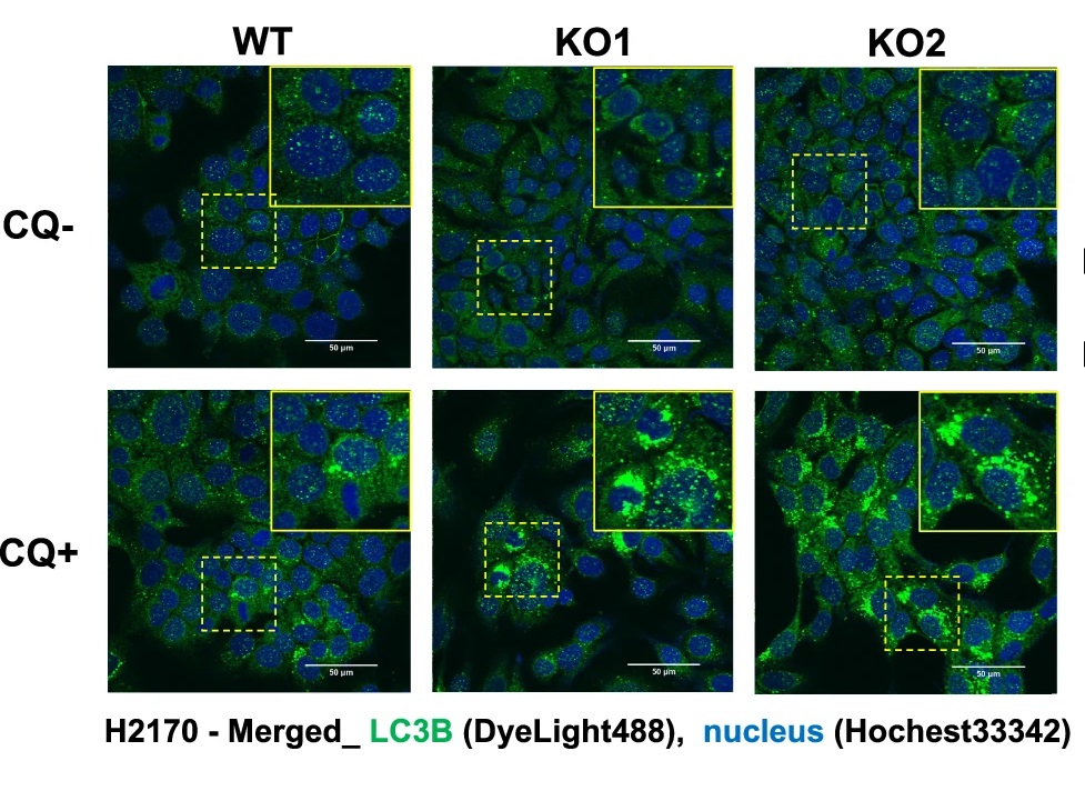 Scientists elucidate the interplay between SLC7A5, mTOR signaling, and autophagy pathways, providing insights into potential strategies to overcome drug resistance in boronophenylalanine-boron neutron capture therapy. 💊

go.nature.com/3TUwSvF