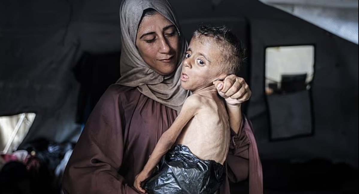adamugarba's tweet image. This is the situation of Gaza children, and the World is watching and doing nothing about it. This is the legacy of Israeli Zionist Regime, enabled and supported by the Western and some Middle Eastern Powers.