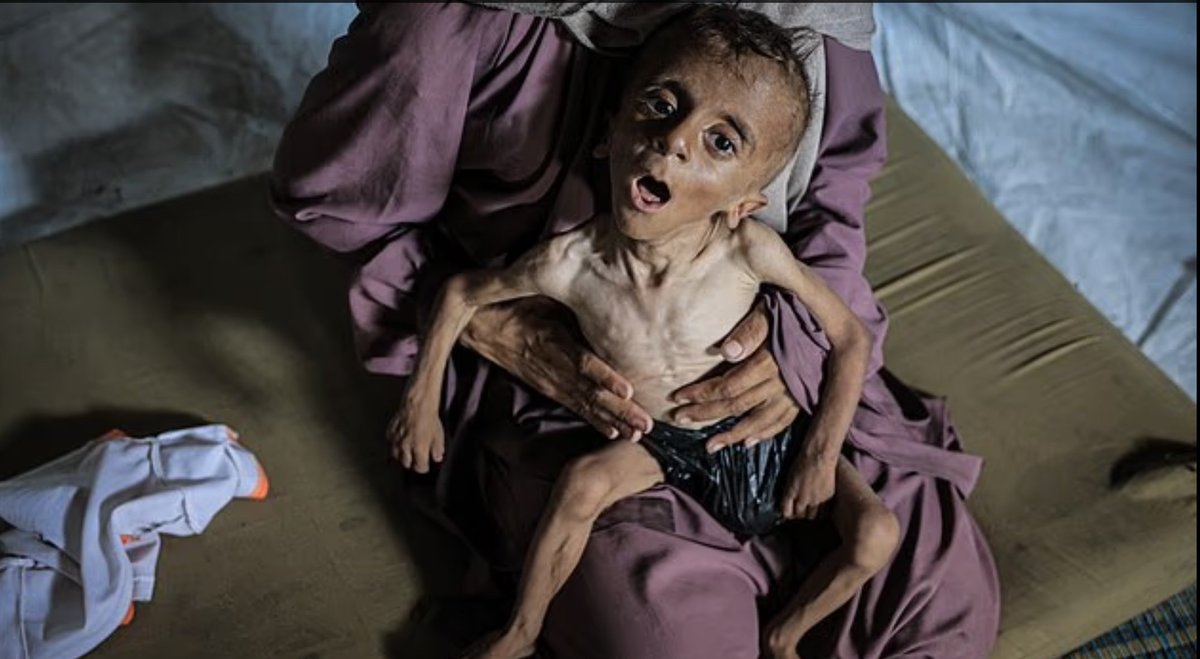 adamugarba's tweet image. This is the situation of Gaza children, and the World is watching and doing nothing about it. This is the legacy of Israeli Zionist Regime, enabled and supported by the Western and some Middle Eastern Powers.