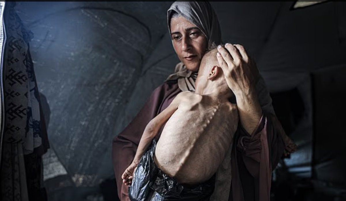 adamugarba's tweet image. This is the situation of Gaza children, and the World is watching and doing nothing about it. This is the legacy of Israeli Zionist Regime, enabled and supported by the Western and some Middle Eastern Powers.