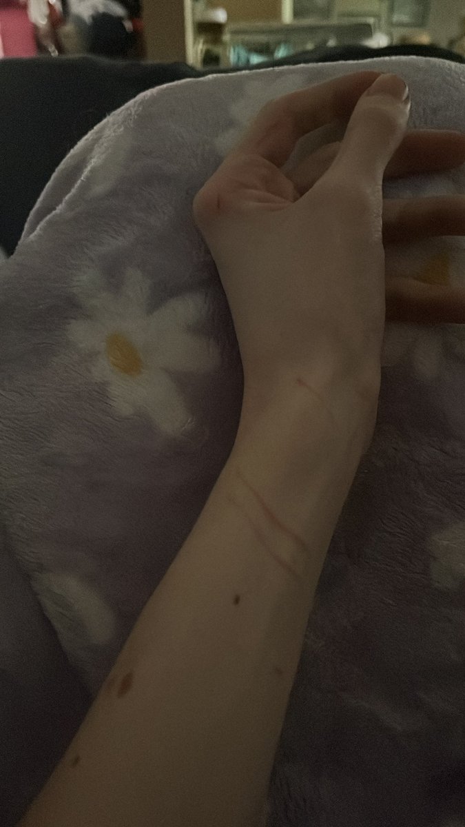 ScaredyCatSana's tweet photo. Sometimes when I feel like SHing I just anger my cat till he scratches me https://t.co/vpMXaOI8ve