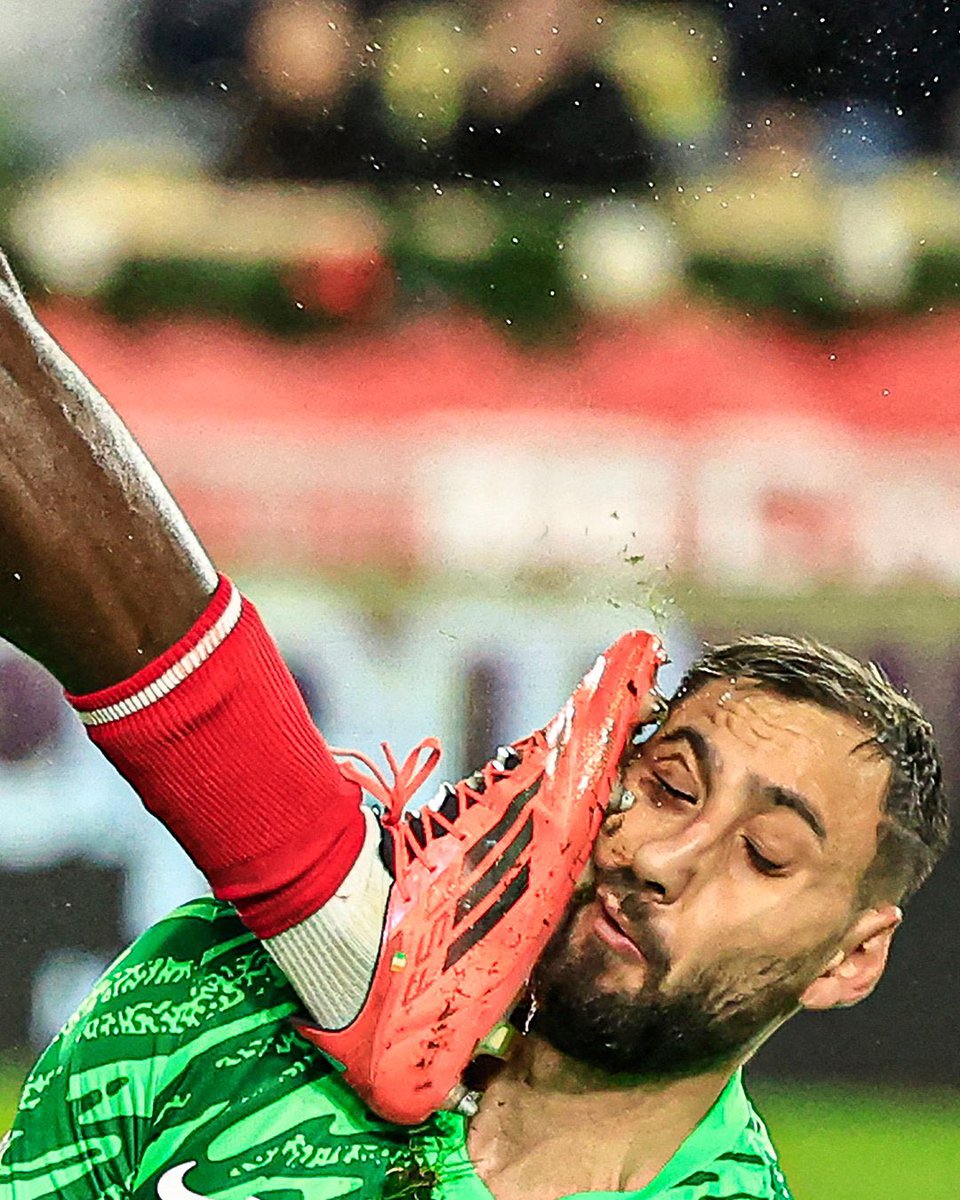 Donnarumma demişken, Donnarumma'nın yüzünde bu kalıcı izi bırakan oyuncu Wilfried Singo'ydu 🤷‍♀️