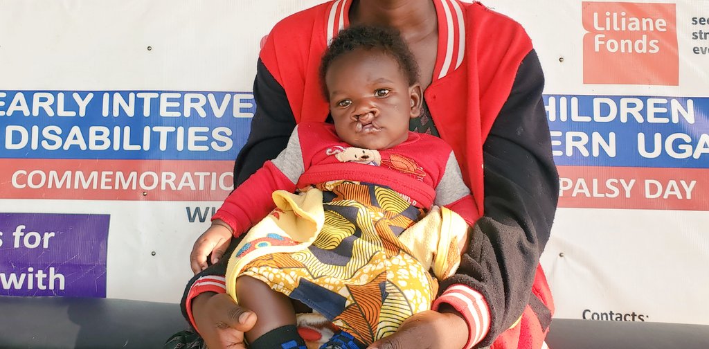 Ruharo Mission Hospital (@ruharohospital) on Twitter photo What have you heard about Cleft Lip and Palate?
Together let's support the affected children to acccess early interventions for better outcomes
<a href="/cbmWorldwide/">CBM Christian Blind Mission</a> <a href="/cbmIHI/">CBM Inclusive Health Initiative</a> <a href="/TBekson/">Dr Bekson Tayebwa π</a> <a href="/mengo_hospital/">Mengo Hospital</a> @Ndyowaawe <a href="/MosesOkipi/">Moses Onyait Okipi</a> <a href="/themwanjap/">themwanjap</a> <a href="/corsuhospital/">CoRSU</a> What have you heard about Cleft Lip and Palate?
Together let's support the affected children to acccess early interventions for better outcomes
<a href="/cbmWorldwide/">CBM Christian Blind Mission</a> <a href="/cbmIHI/">CBM Inclusive Health Initiative</a> <a href="/TBekson/">Dr Bekson Tayebwa π</a> <a href="/mengo_hospital/">Mengo Hospital</a> @Ndyowaawe <a href="/MosesOkipi/">Moses Onyait Okipi</a> <a href="/themwanjap/">themwanjap</a> <a href="/corsuhospital/">CoRSU</a>