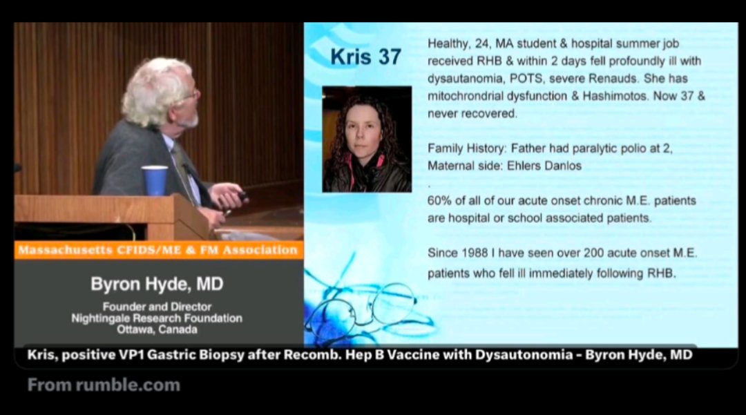 AnneSpaceCoast's tweet image. rumble.com/v6ui5tj-kris-p…
"Since 1988 I have seen over 200 acute onset M.E. patients who fell immediately following Recomb. Hep B vaccine"-
Dr Byron Hyde"