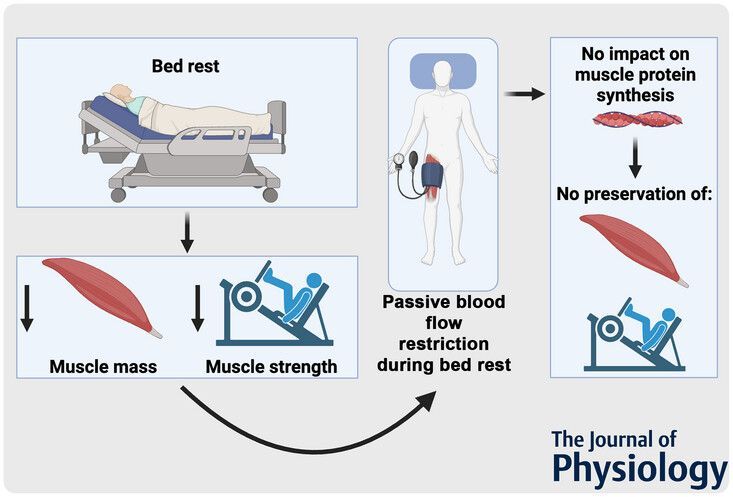 Journal of Physiology (@jphysiol) on Twitter photo This study by Cas J. Fuchs (<a href="/NMS_UM/">Nutrition and Movement Sciences UM</a>) et al. found that daily blood flow #restriction does not preserve muscle mass and #strength during 2 weeks of bed rest ⏰ 🛌
Read the #Research here: buff.ly/t5XXGPH This study by Cas J. Fuchs (<a href="/NMS_UM/">Nutrition and Movement Sciences UM</a>) et al. found that daily blood flow #restriction does not preserve muscle mass and #strength during 2 weeks of bed rest ⏰ 🛌
Read the #Research here: buff.ly/t5XXGPH