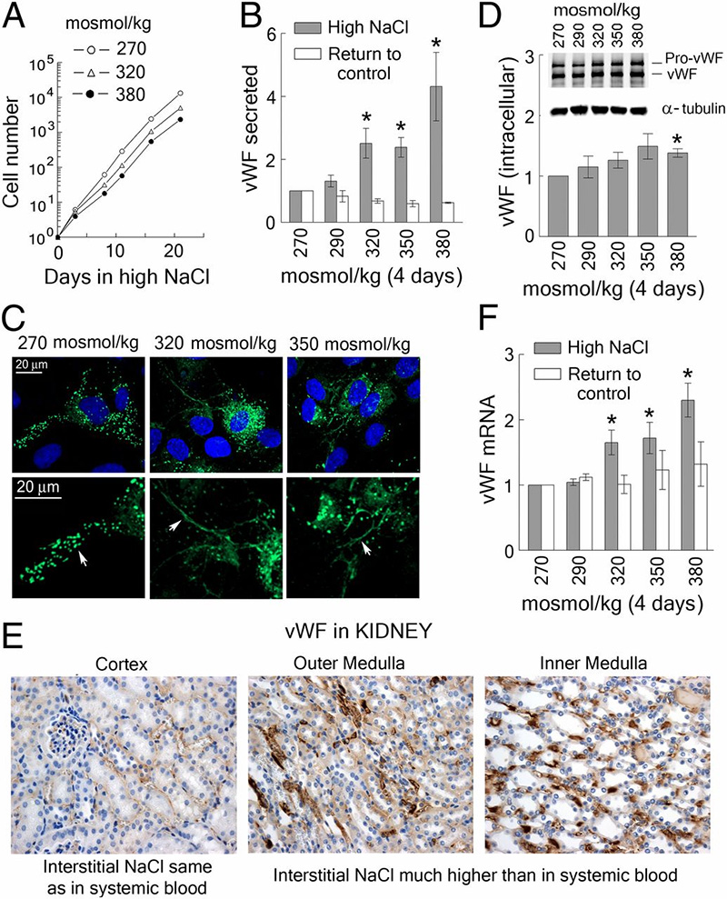 Friday Hope: Reducing Sodium Intake: Taming Macrophages, Protecting the Endothelium and Inhibiting the Spike Protein

Salt enhances all things Spike. Reducing sodium intake during acute COVID, Long COVID and Spike Protein Disease/Injury may accelerate the path towards healing.