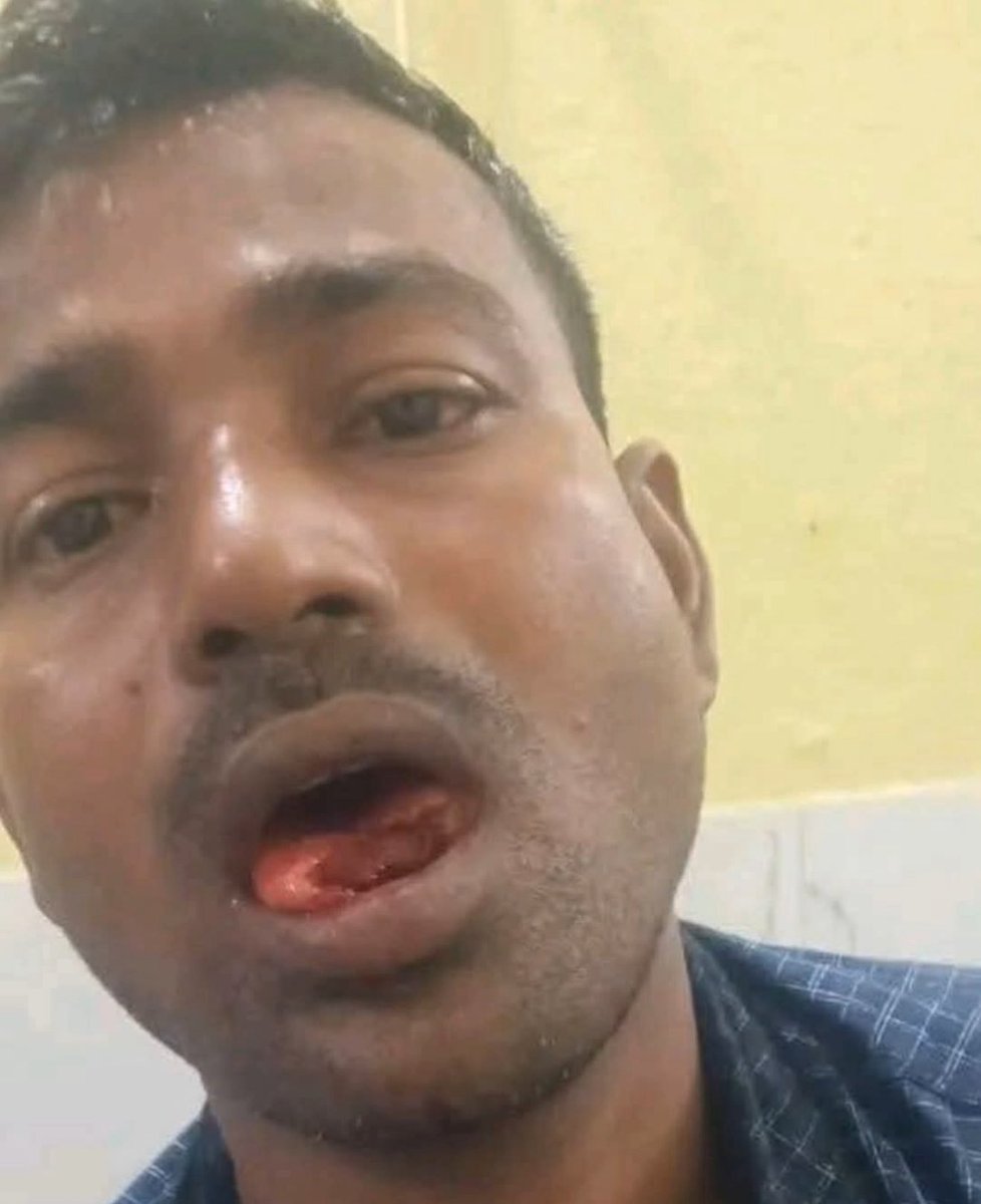 Dr_Rizwan_'s tweet image. बिहार के गया जी ज़िला में पत्नी ने झगड़े के दौरान पति की जीभ काटकर निगल ली पति ICU में है, पर अब तक कोई FIR नहीं हुई है
ऐसा लगता है की अब रिश्तों में संवाद मरता जा रहा है, और हिंसा आम होती जा रही है