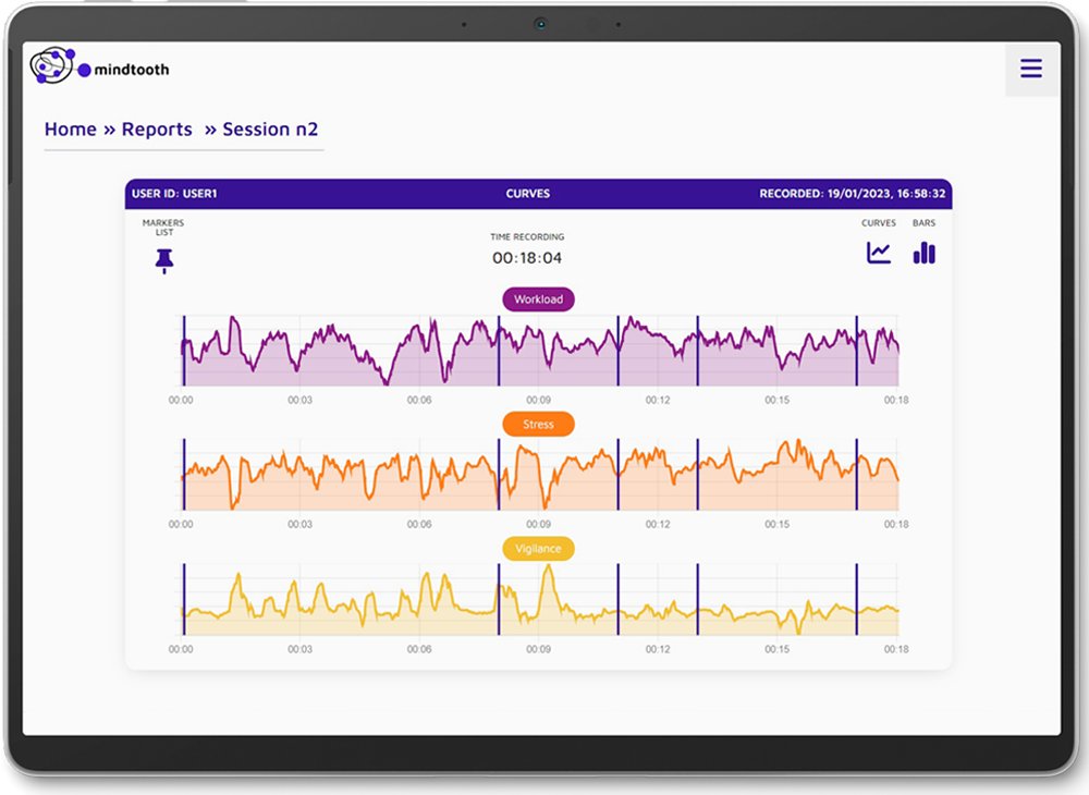 Brain_Products's tweet image. The #Mindtooth EEG system is the result of a European project with @BrainSigns. Its award-winning design enables the measurement of mental states without technical skills. Discover how to monitor workload, vigilance or stress levels on the go with ease. mindtooth-eeg.com/?utm_source=tw…