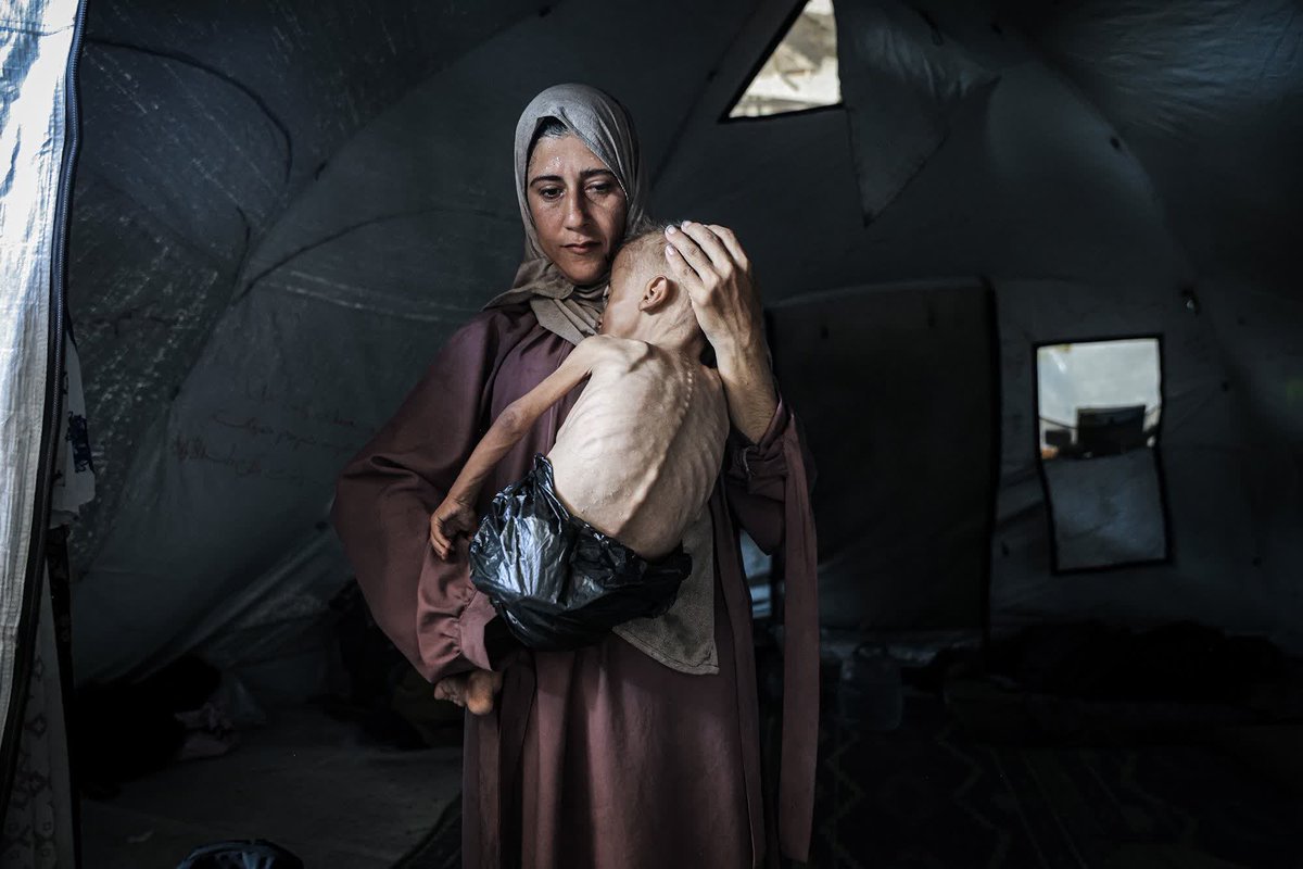 Muhammad Zakariya Ayyoub al-Matouq, an 18-month-old child in Gaza City, starving to death in front of our eyes. Being AGAINST genocide is NOT antisemitism. 
Speak out. Put pressure on your government to STOP helping Netanyahu murder innocent civilians.