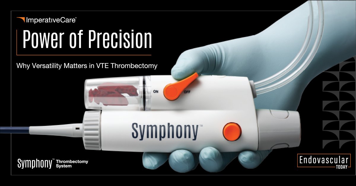 ImpCare_Vasc's tweet photo. In this NEW @EVToday clinical article, Dr. Bennet George, Dr. Rahul Patel (@RSP516), Dr. David Kim (@DkimMD), and Dr. David Dexter explore how they are using the #SymphonySystem to tackle a wide range of #VTE presentations in their practice – without compromise.
Read to learn how utilizing Symphony with a clinician-refined procedural algorithm delivers full spectrum results: minimal blood loss, aspiration of a wide range of clot chronicity, short device times, and predictable results.
Check out the full article: https://t.co/u2d5BSfZXY
Rx only. ISI: https://t.co/Q5HSdTIghf
#Thrombectomy #InterventionalRadiology #VascularSurgery #InterventionalCardiology