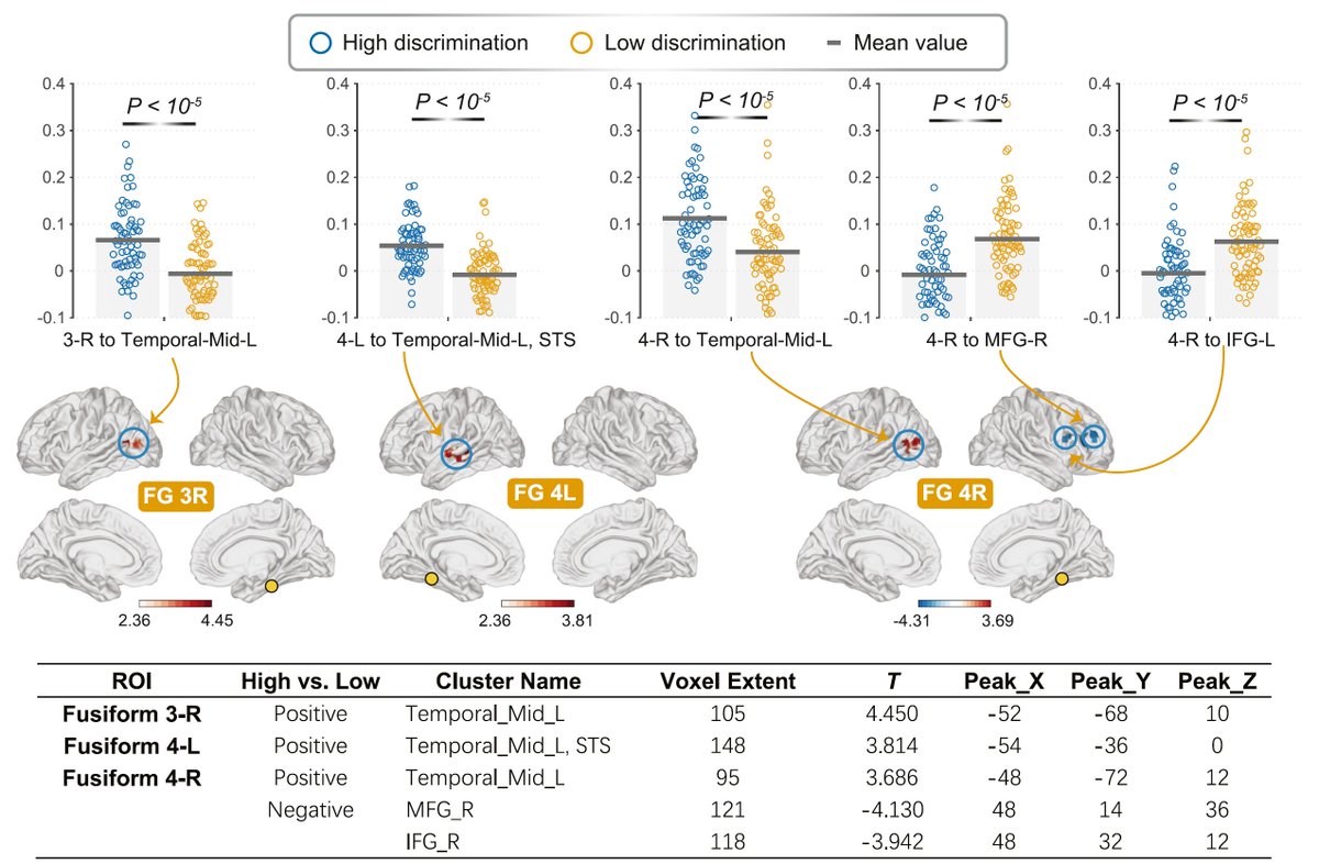h_wang90's tweet photo. Higher discrimination is associated with:
🔺 Stronger connectivity between the Fusiform Face Area (FFA) and social perception areas (MTG/STS).
🔻 Weaker connectivity between the FFA and frontal regulatory regions (IFG/MFG).
#Neuroimaging #Neuroscience @ArpanaChurch @XiaobeiZhang0 https://t.co/aifnzDtxXp