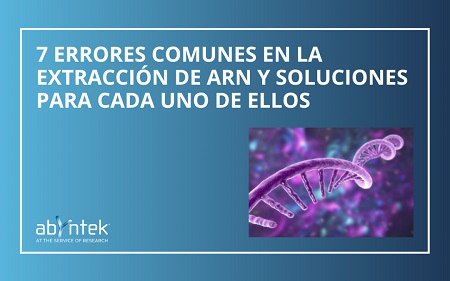 Biotech_Spain's tweet image. .@Abyntek 7 errores comunes en la extracción de ARN y soluciones para cada uno de ellos biotech-spain.com/es/articles/7-…