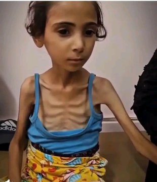 Alnour123's tweet photo. غزة تموت جوعاً وعطشاً
انقذو غزة أيها الحكام العرب والمسلمين
انقذو أطفال غزة من الجوع
انقذو المسنين لا يوجدو علاج
انقذو الجرحى والمصابين 
#غزه_تموت_جوعاً https://t.co/QKRiOFWa3y